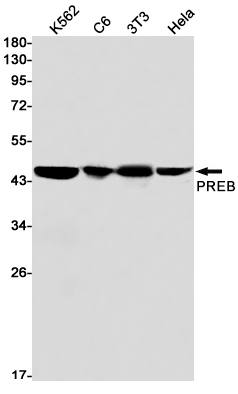 PREB Rabbit mAb