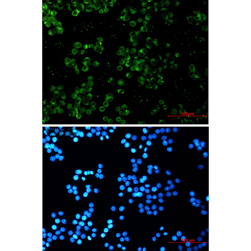 TREX1 Rabbit mAb