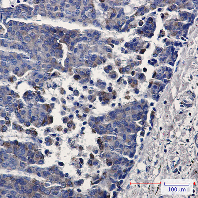 TREX1 Rabbit mAb