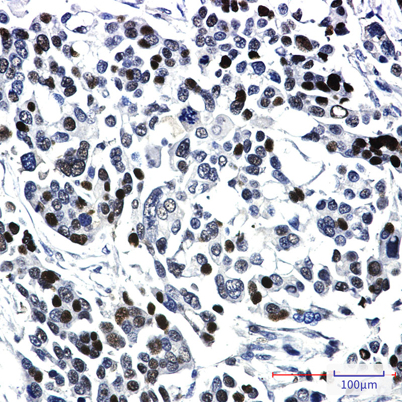 KAT13A Rabbit mAb