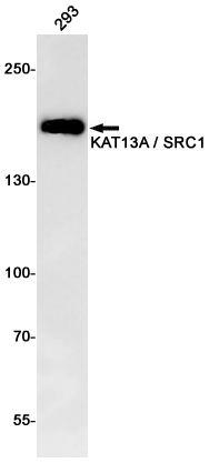 KAT13A Rabbit mAb