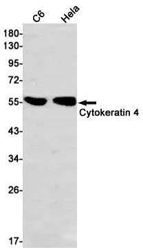 Cytokeratin 4 Rabbit mAb