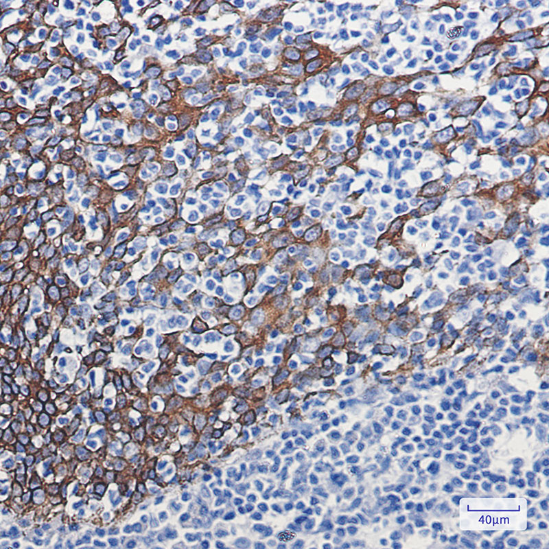 Cytokeratin 16 Rabbit mAb