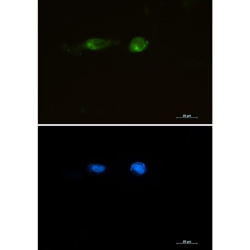 LRP1 Rabbit mAb