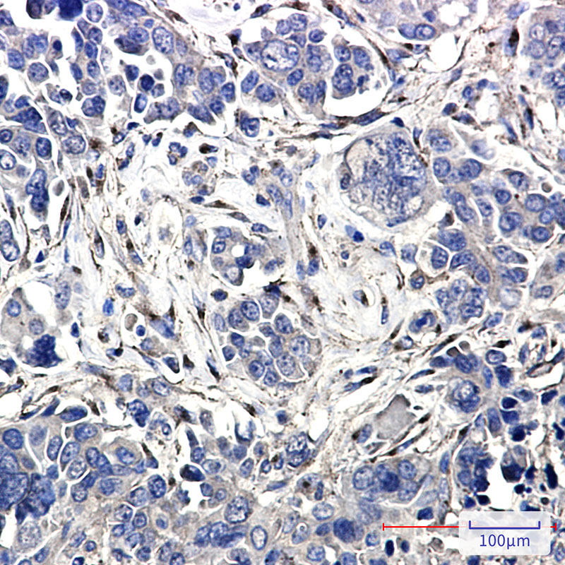 LRP1 Rabbit mAb