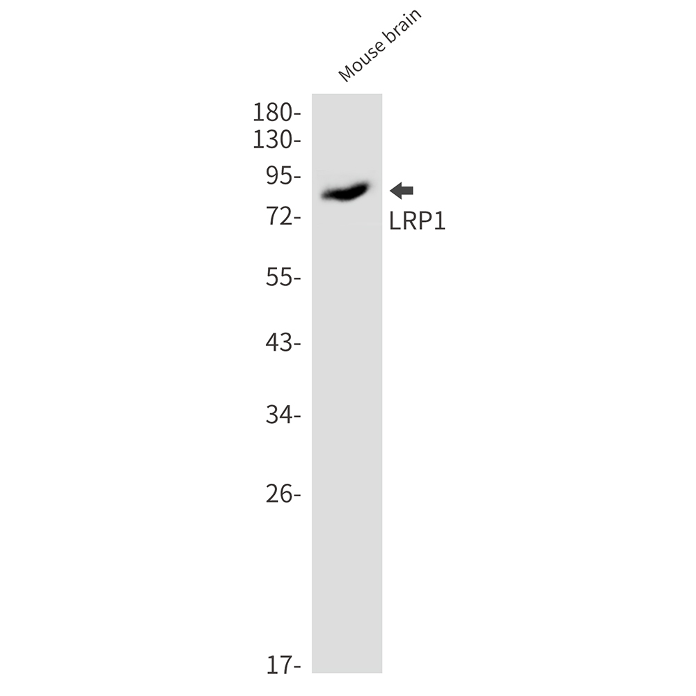 LRP1 Rabbit mAb