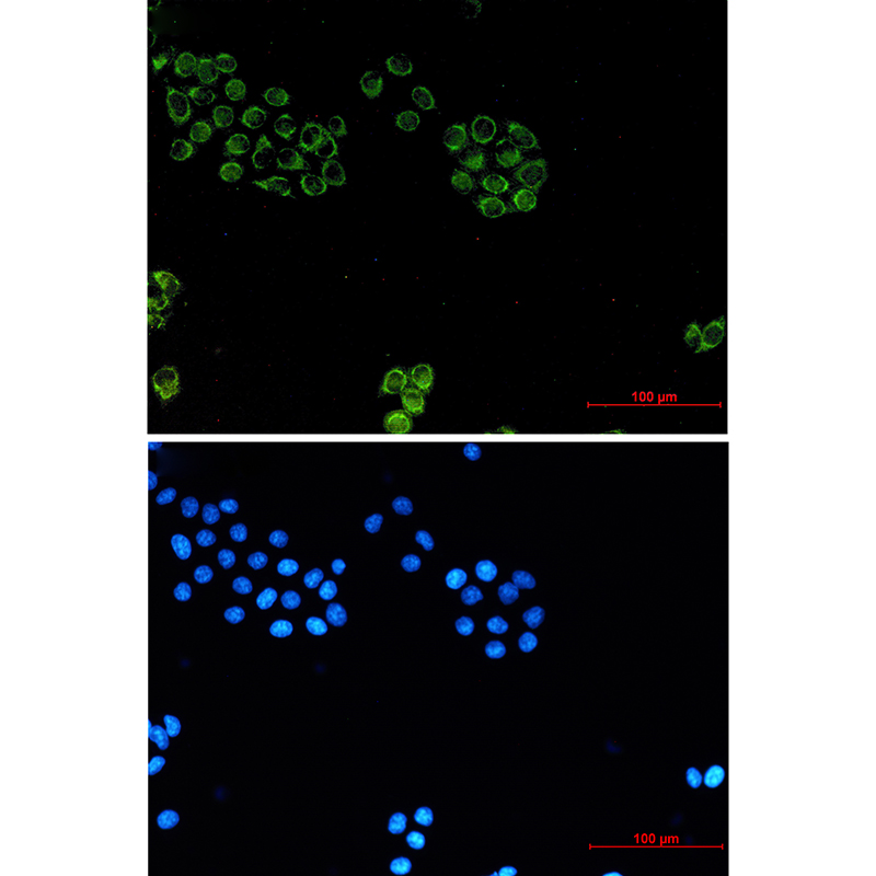 Glypican 1 Rabbit mAb