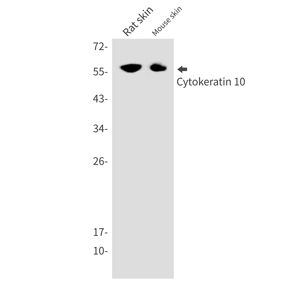 Cytokeratin 10 Rabbit mAb