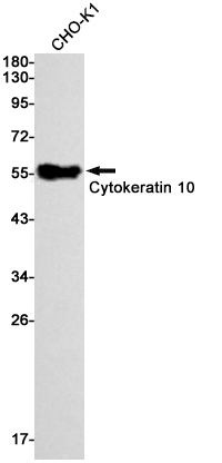 Cytokeratin 10 Rabbit mAb