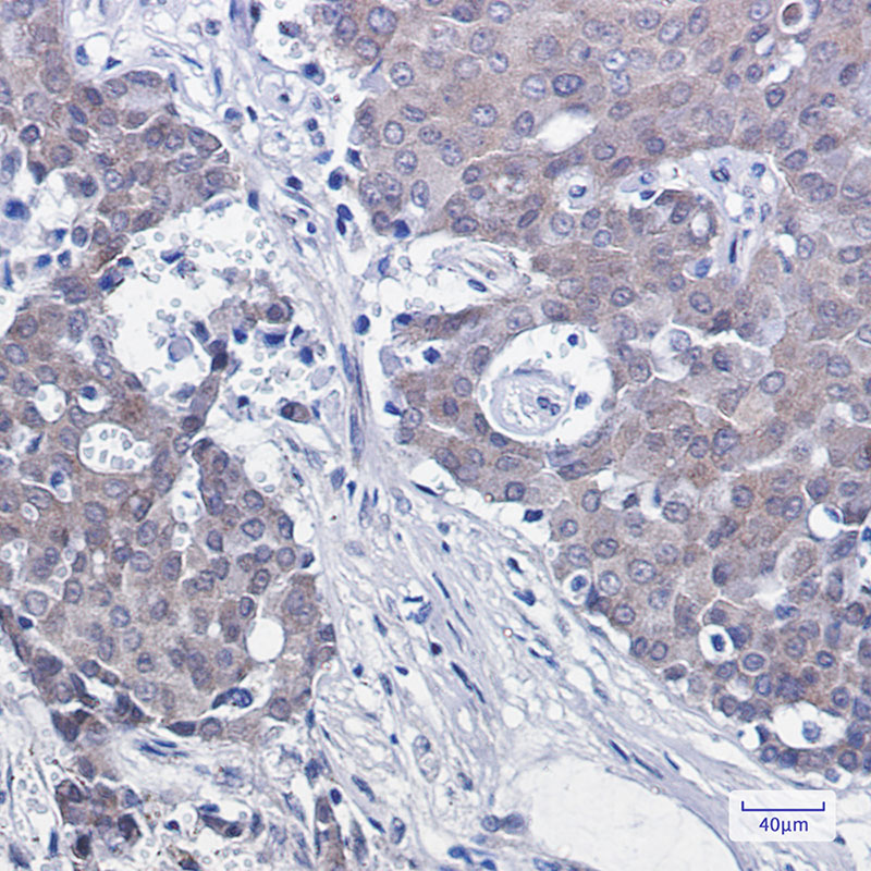 NEDD8 Rabbit mAb