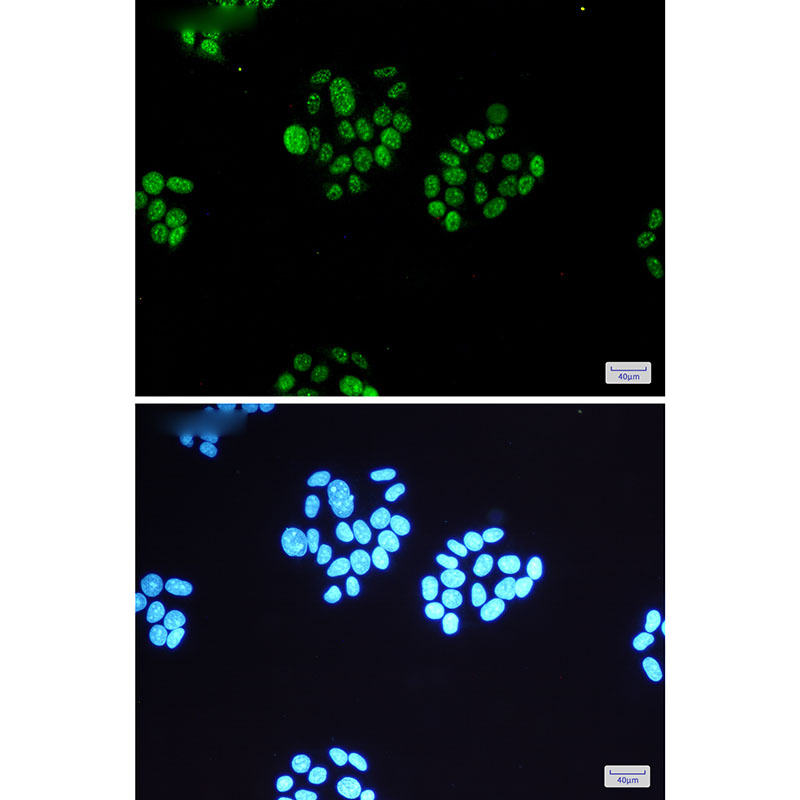Phospho-MSK1 (Ser360) Rabbit mAb