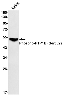 Phospho-PTP1B (Ser352) Rabbit mAb