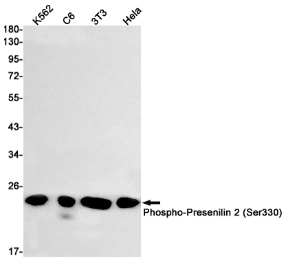 Phospho-Presenilin 2 (Ser330) Rabbit mAb
