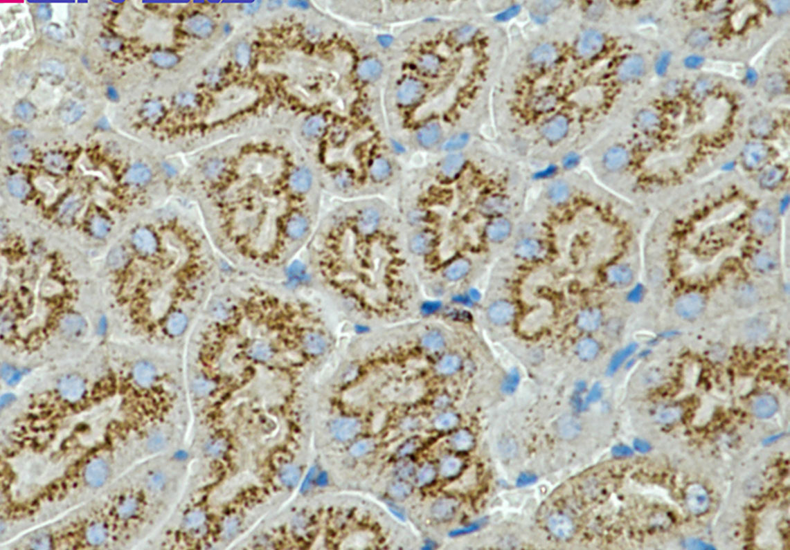 CD63 Rabbit mAb