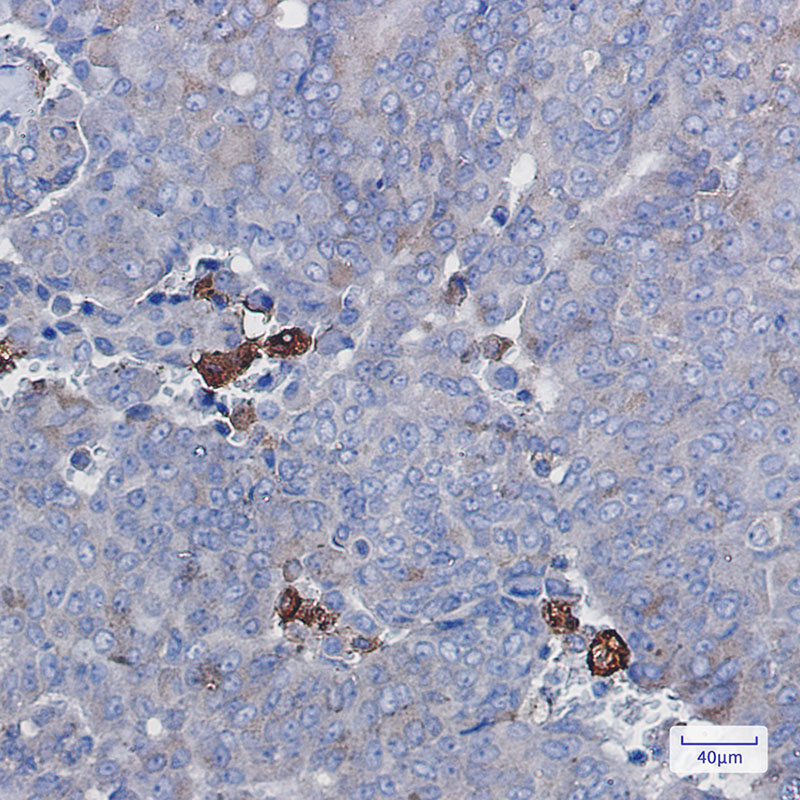 Amyloid Precursor Protein Rabbit mAb