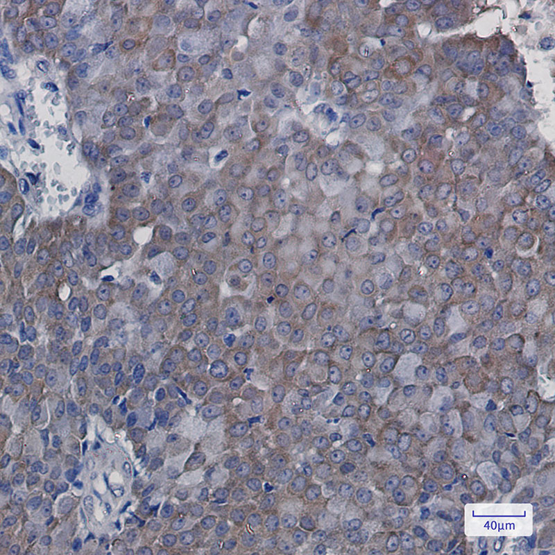 eIF5A Rabbit mAb