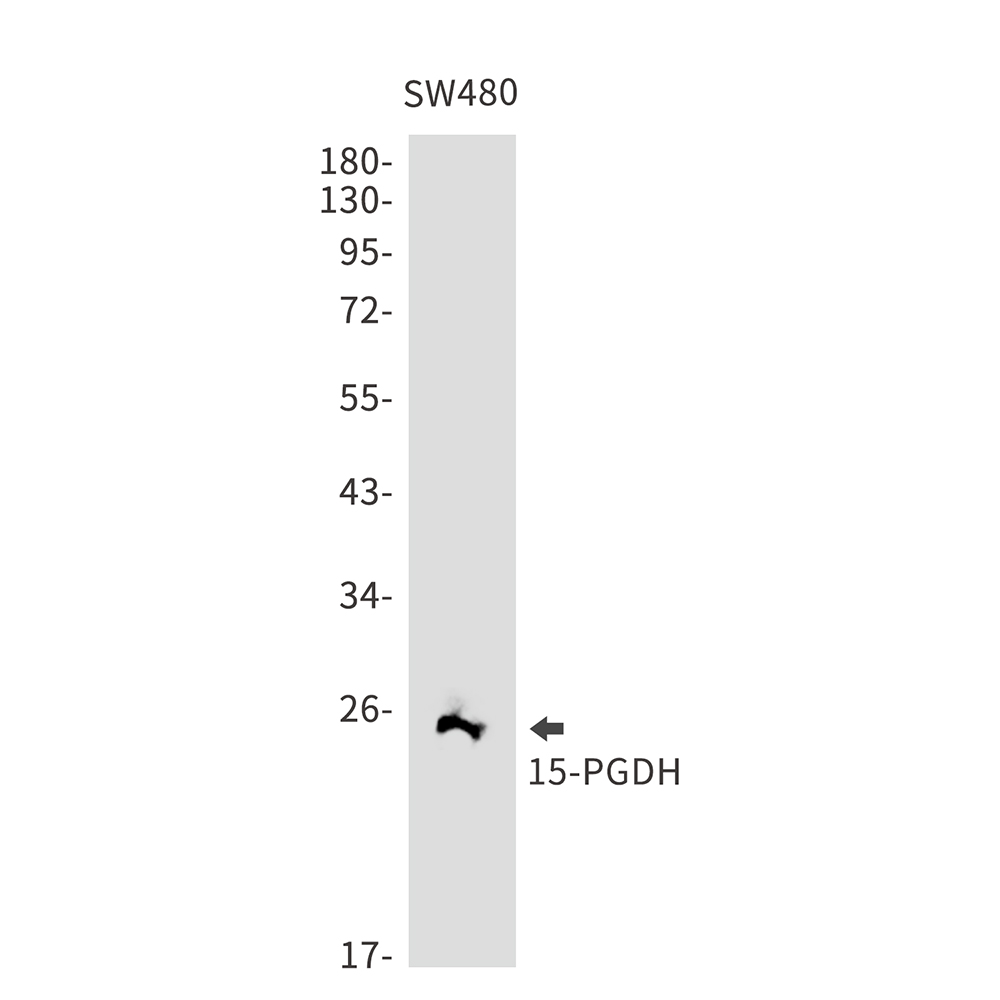 15 PGDH Rabbit mAb