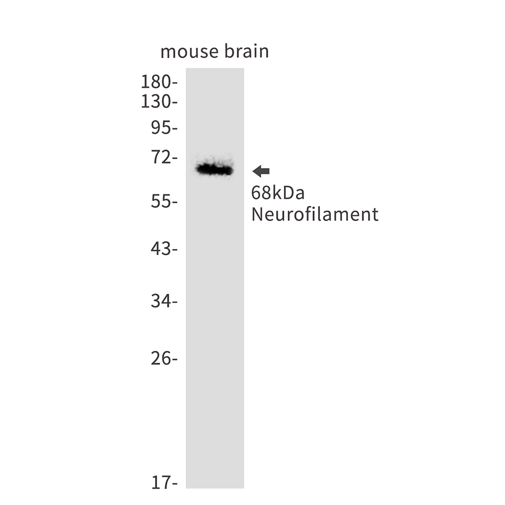 Neurofilament light polypeptide Rabbit mAb