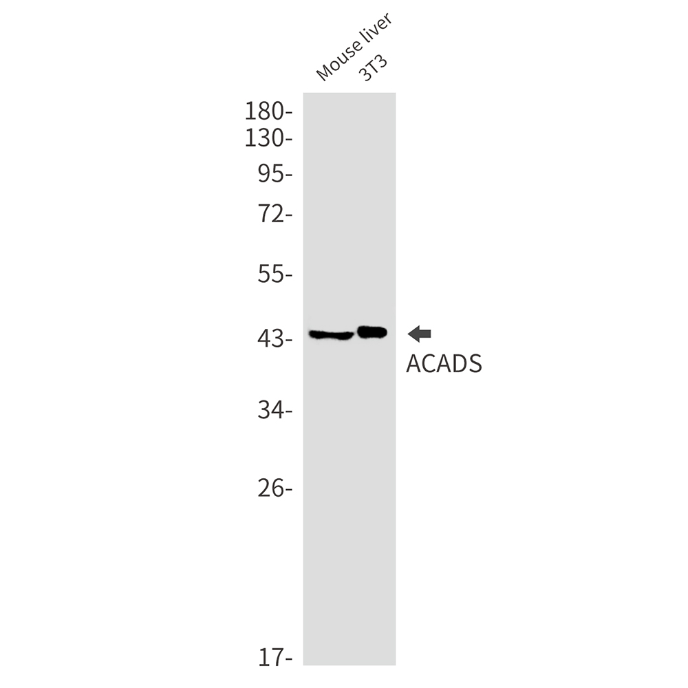 ACADS Rabbit mAb