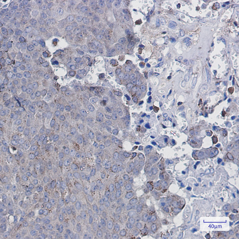 Adipose Triglyceride Lipase Rabbit mAb