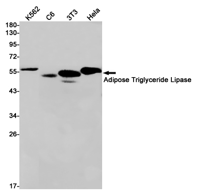 Adipose Triglyceride Lipase Rabbit mAb