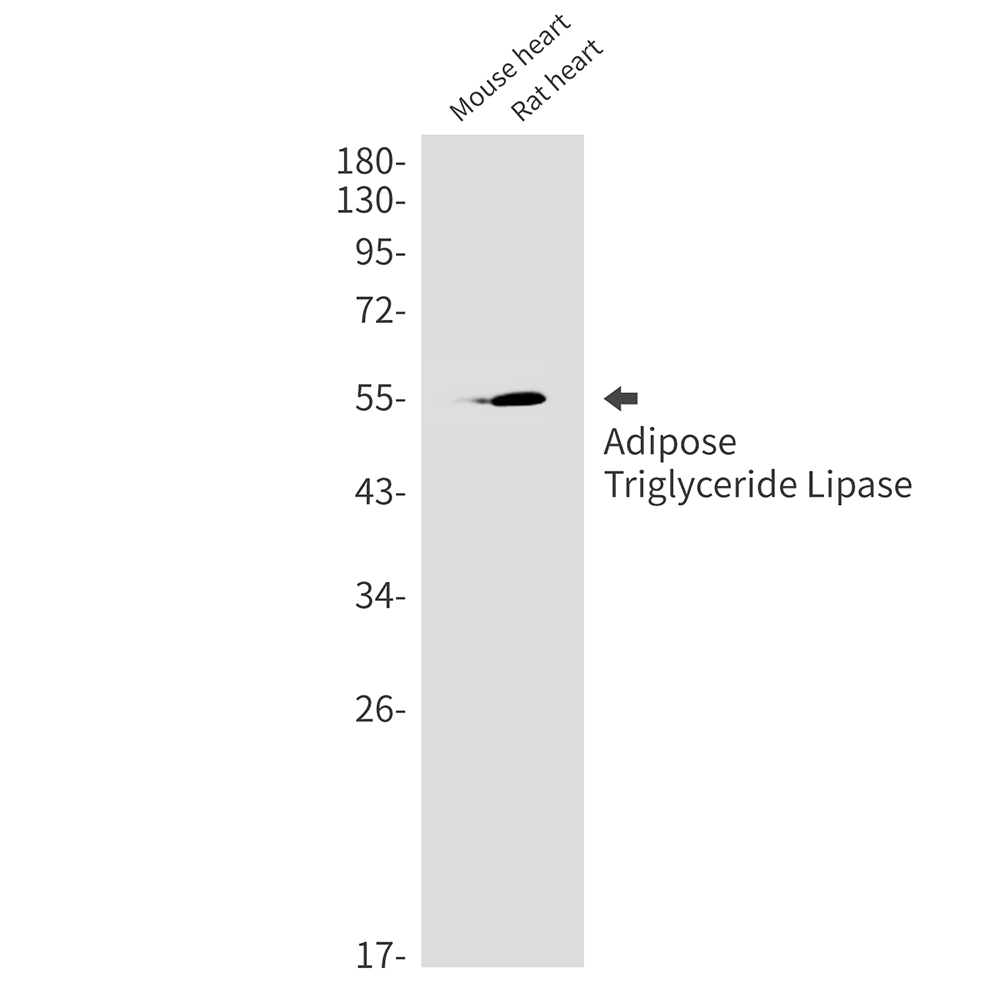 Adipose Triglyceride Lipase Rabbit mAb