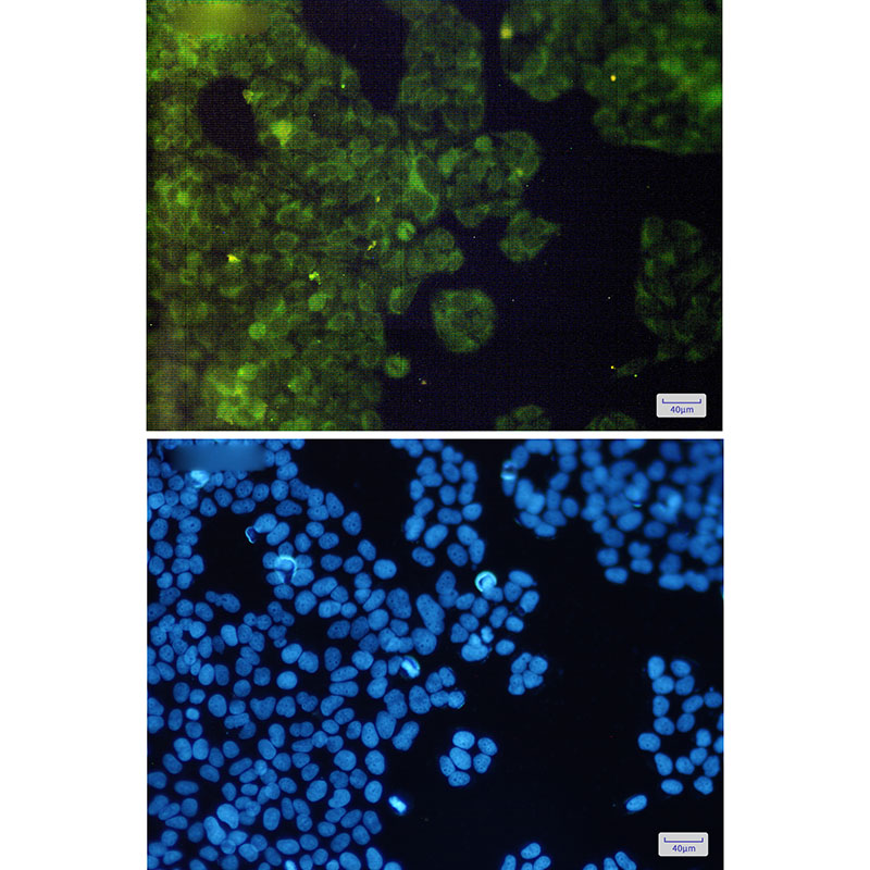 AdSS 2 Rabbit mAb