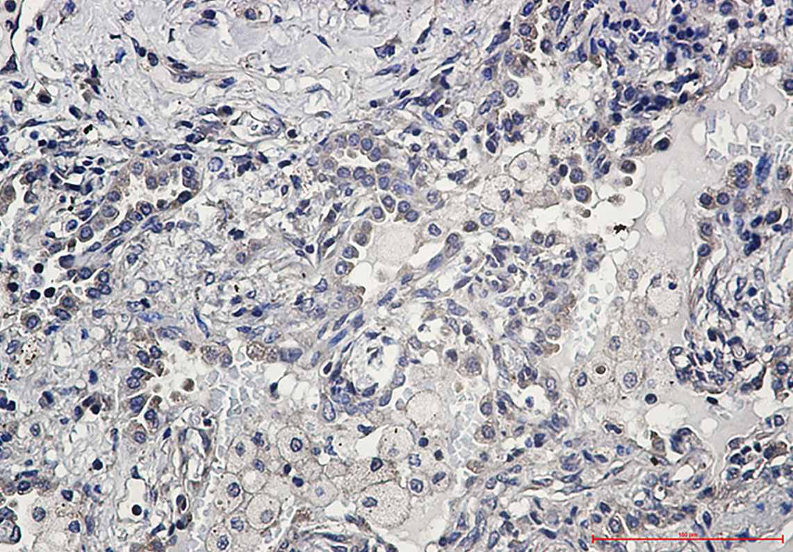 AKT Rabbit mAb