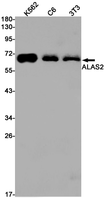 ALAS2 Rabbit mAb