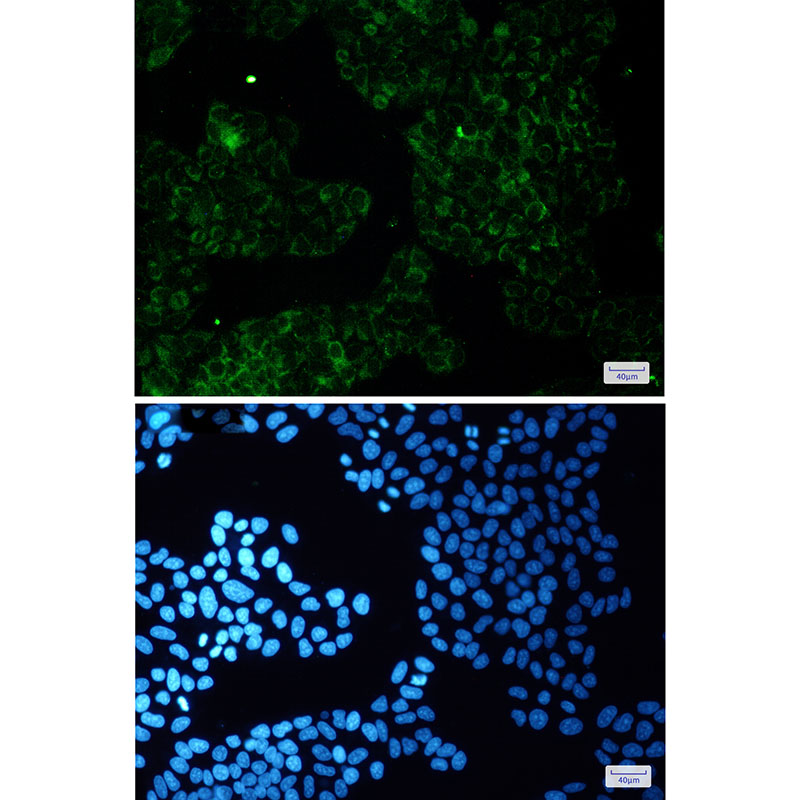 ALDH7A1 Rabbit mAb