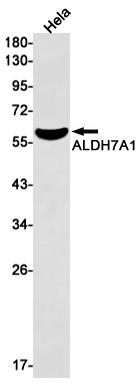 ALDH7A1 Rabbit mAb