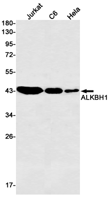 ALKBH1 Rabbit mAb