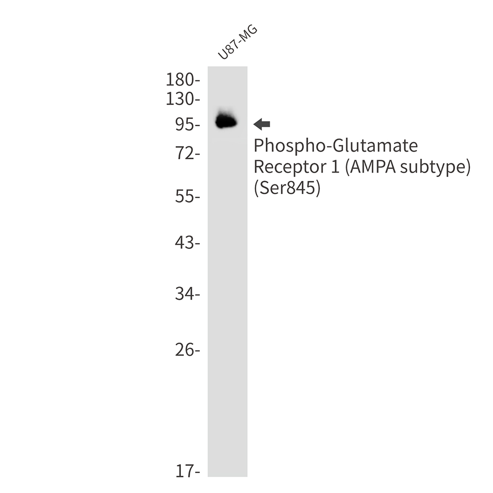 Phospho-Glutamate Receptor 1 (AMPA Subtype) (Ser845) Rabbit mAb