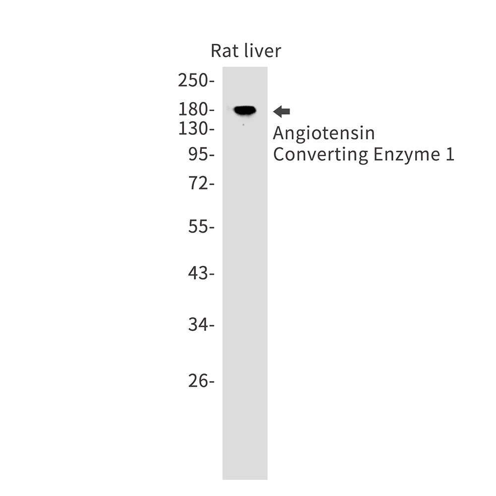 Angiotensin Converting Enzyme 1 Rabbit mAb