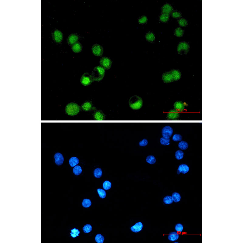 Transcription Factor AP 2 gamma Rabbit mAb