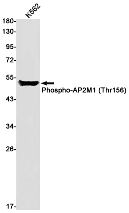 Phospho-AP2M1 (Thr156) Rabbit mAb
