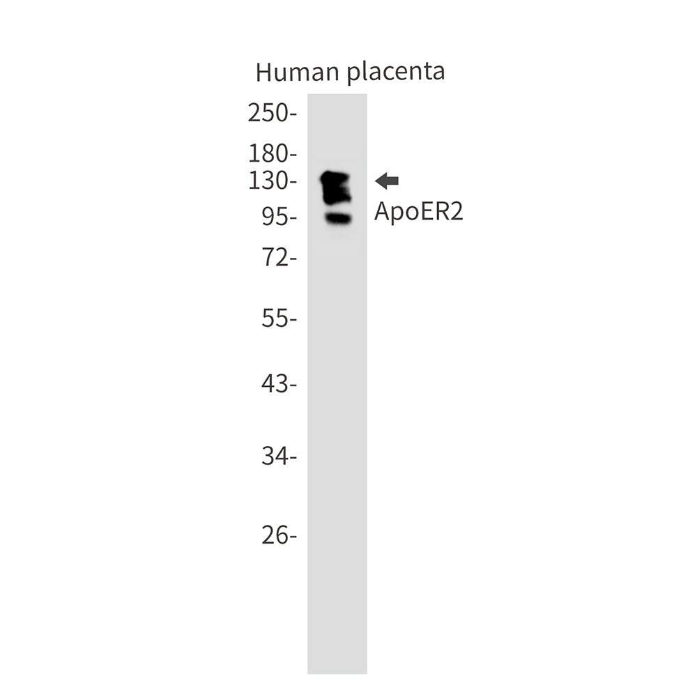 ApoER2 Rabbit mAb