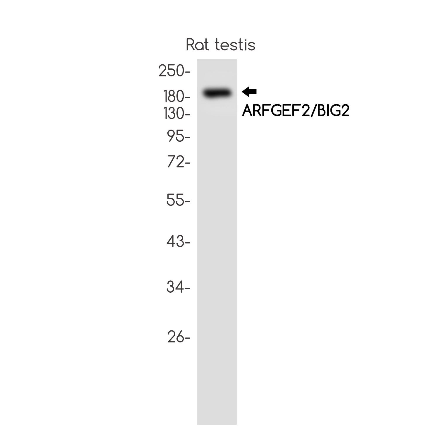 ARFGEF2 Rabbit mAb
