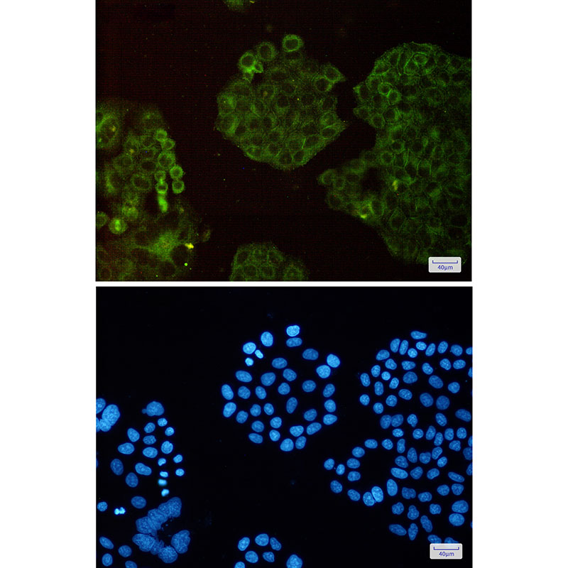 Actin Related Protein 3 Rabbit mAb