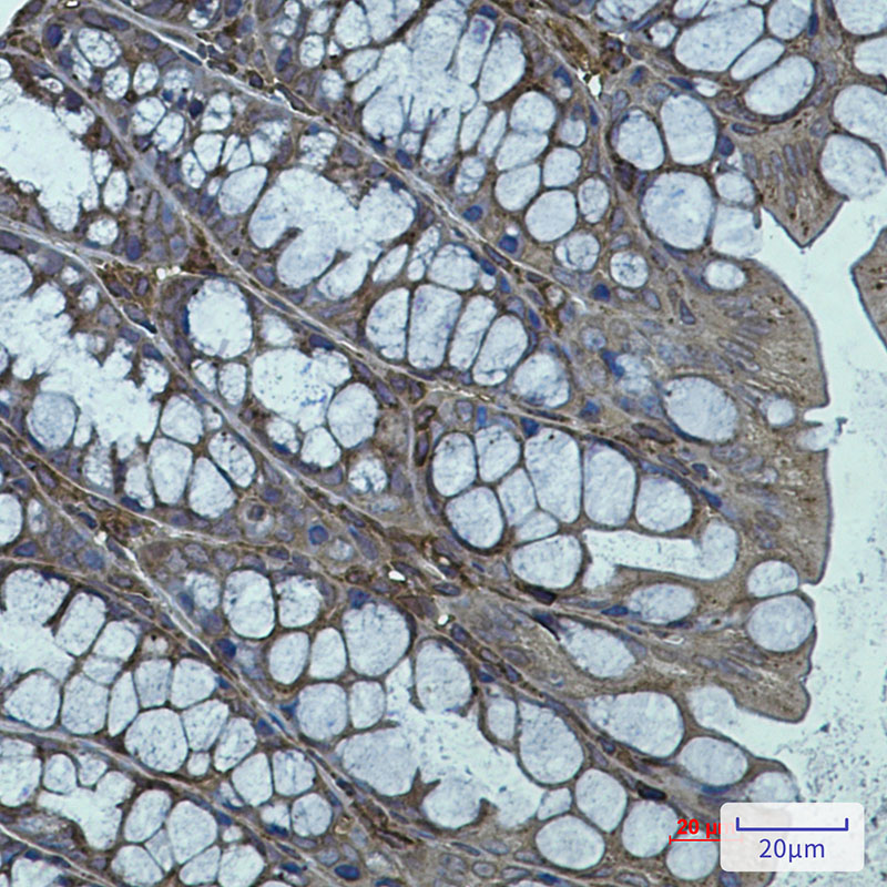 Actin Related Protein 3 Rabbit mAb