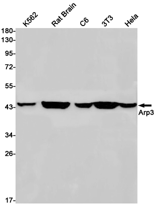 Actin Related Protein 3 Rabbit mAb