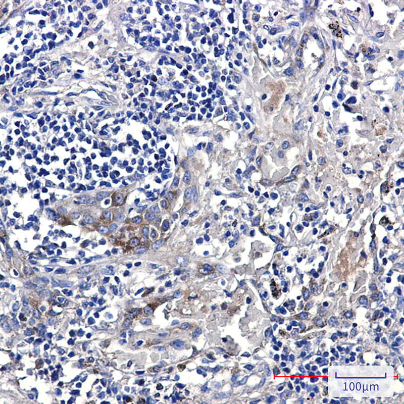 ERAP1 Rabbit mAb
