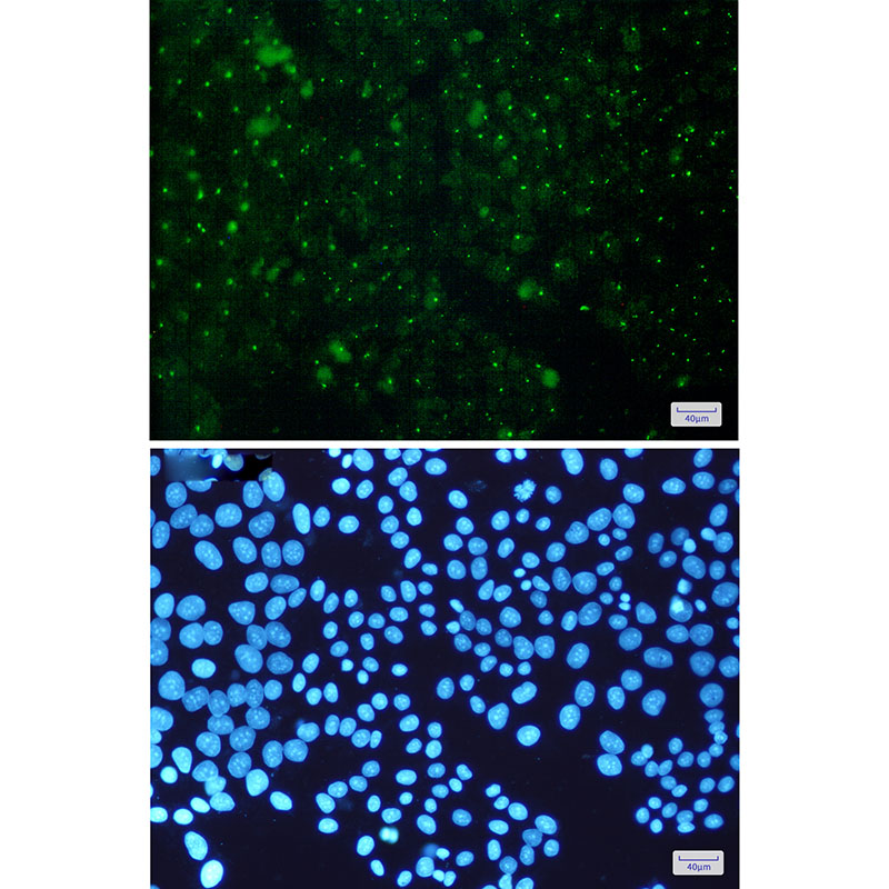Aryl Hydrocarbon Receptor Rabbit mAb