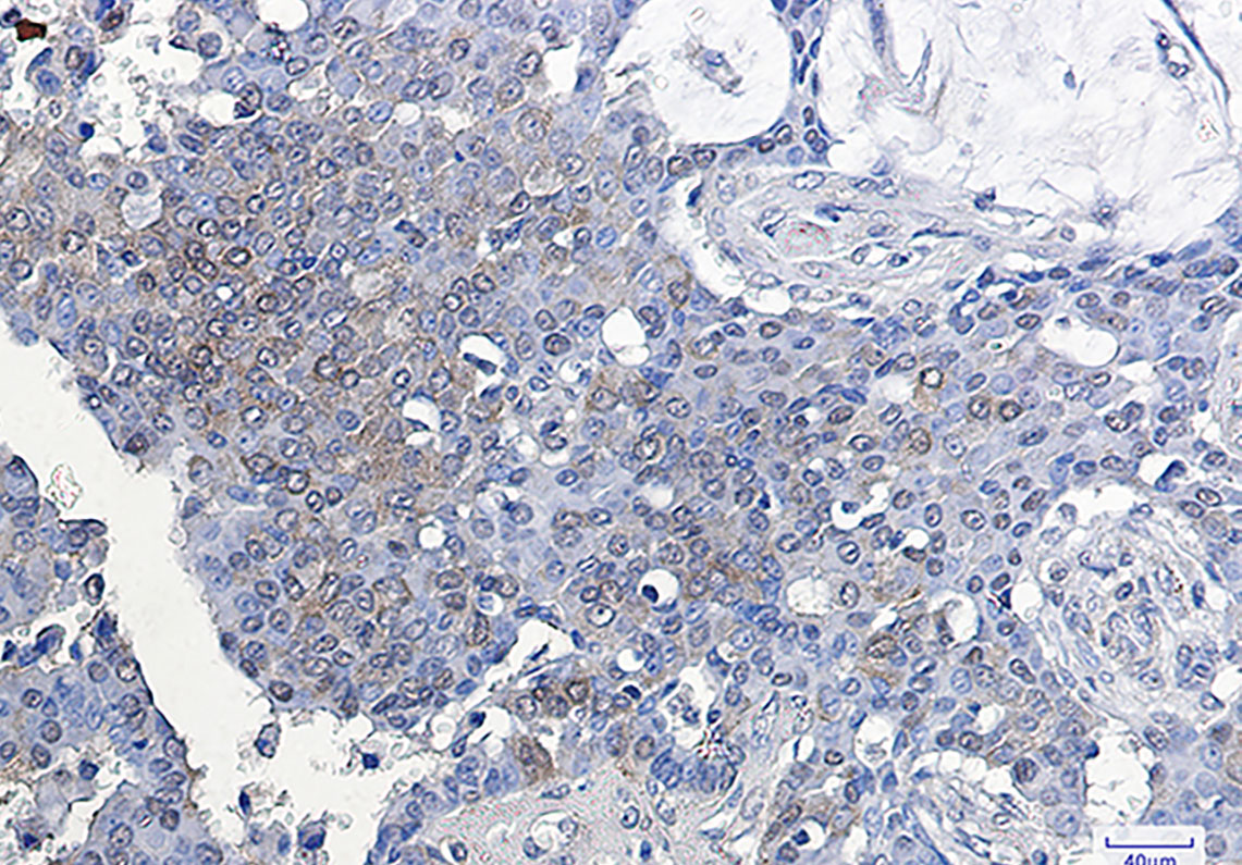 ATF5 Rabbit mAb