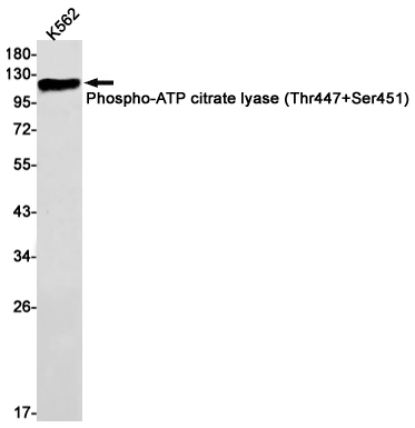 Phospho-ATP Citrate Synthase (Thr447/Ser451) Rabbit mAb