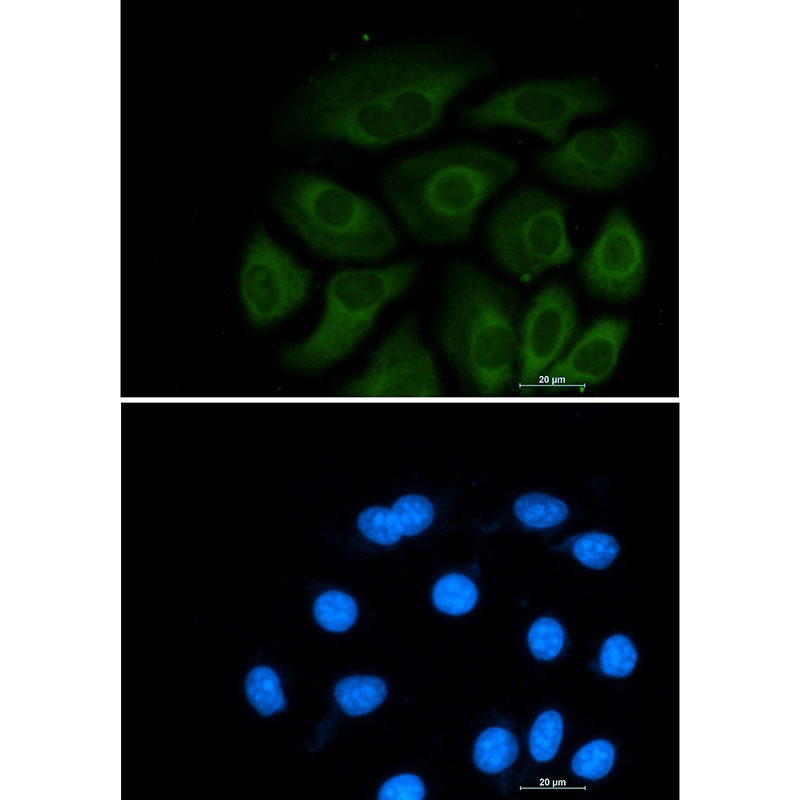 ATP Citrate lyase Rabbit mAb