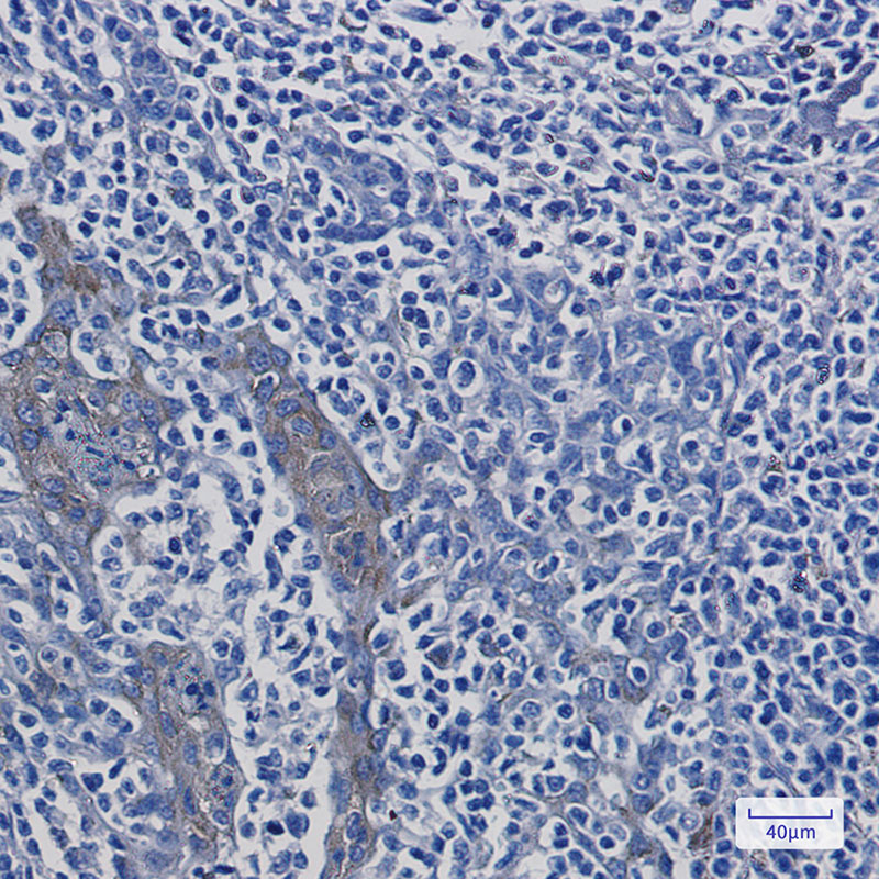 ATP6V1A Rabbit mAb
