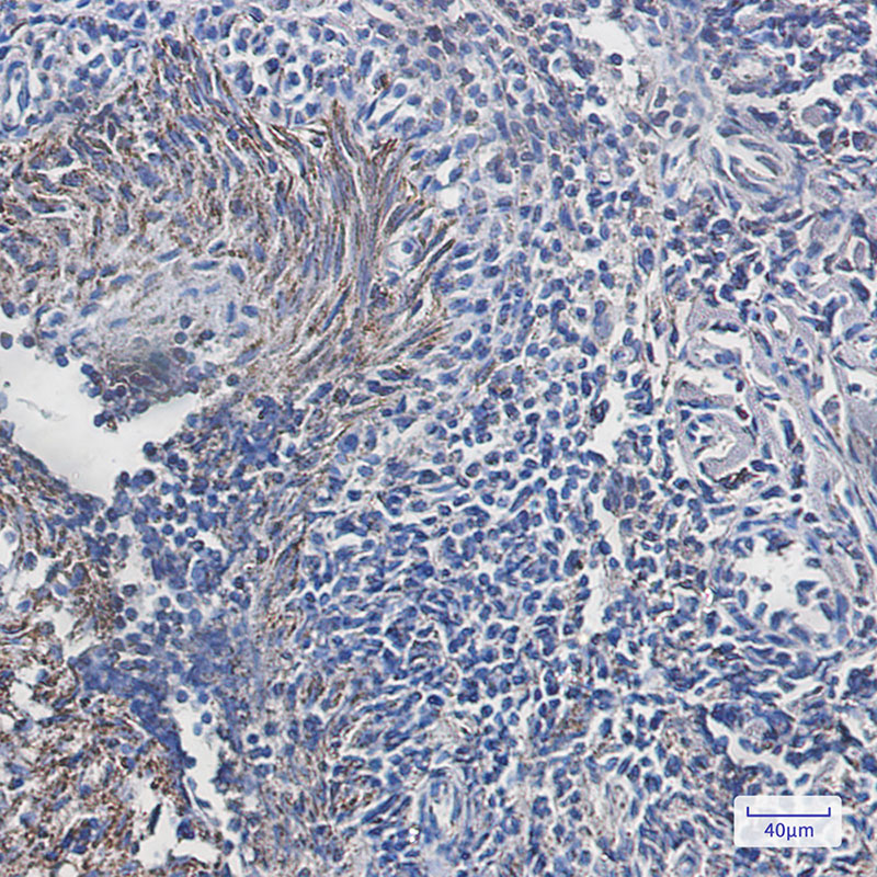 ATPB Rabbit mAb