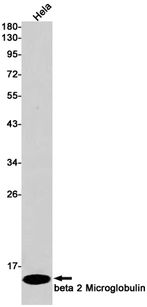 beta 2 Microglobulin Rabbit mAb
