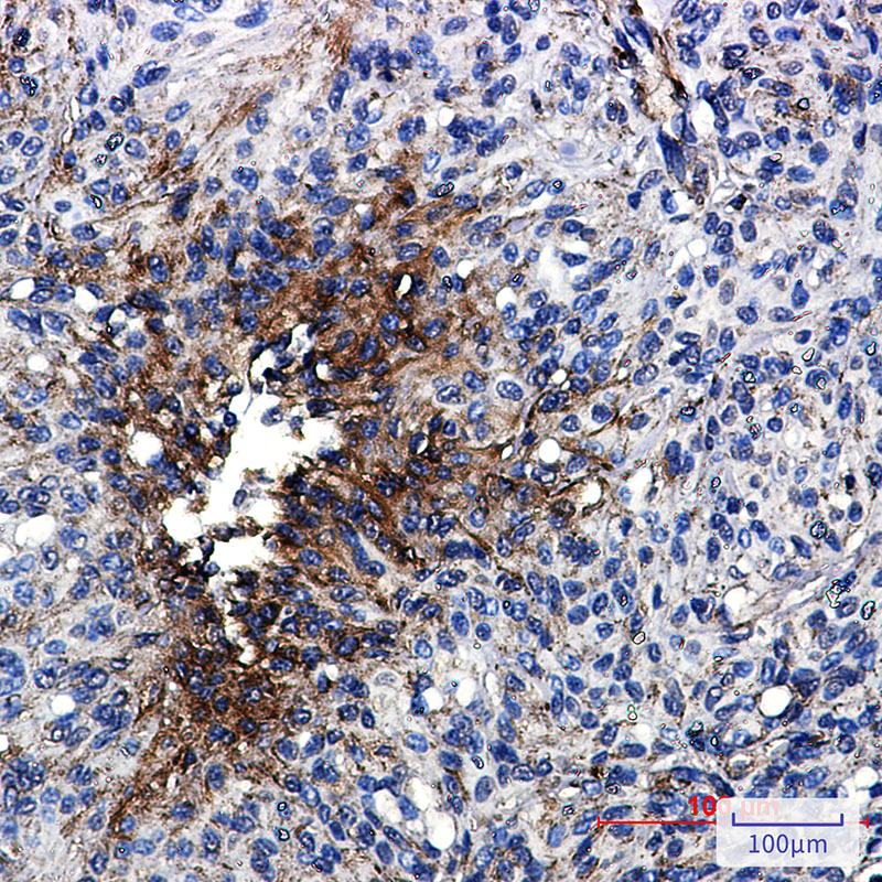 beta IV Tubulin Rabbit mAb